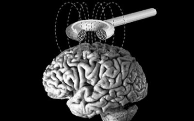 La stimulation cerebrale comme traitement de l’addiction à la cocaïne