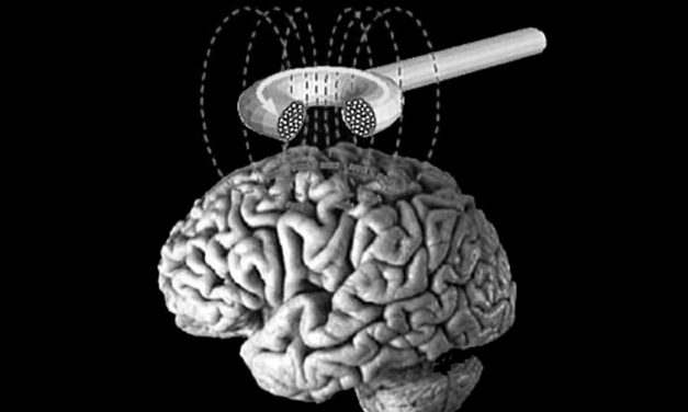 La stimulation cerebrale comme traitement de l’addiction à la cocaïne